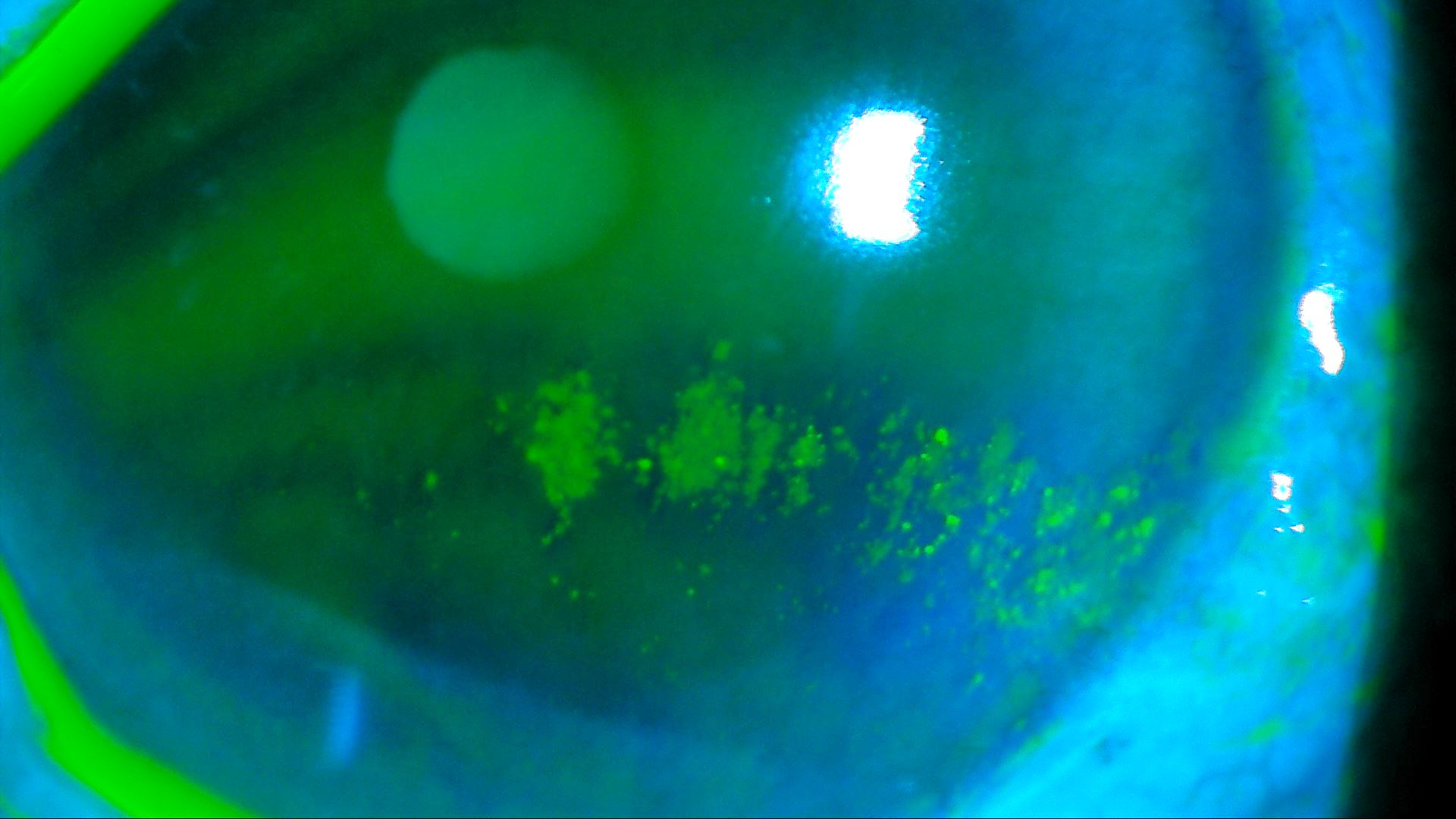 目の傷の有無・程度を探る顕微鏡検査