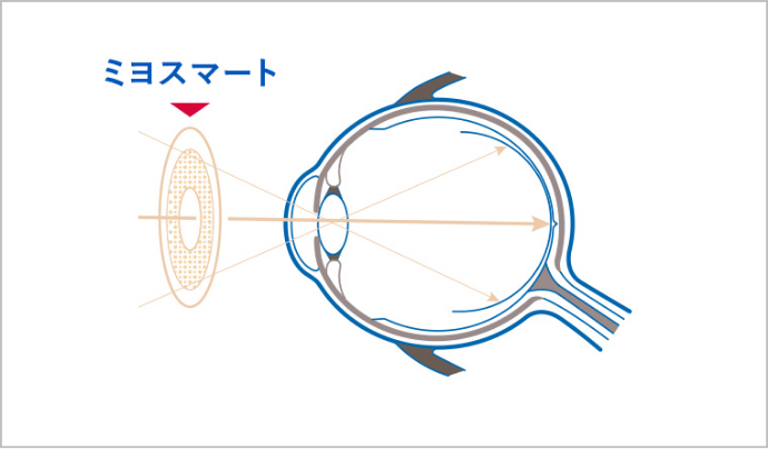 ミスマートによる補正
